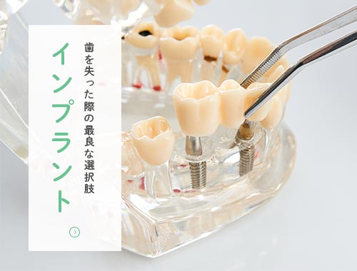 インプラント